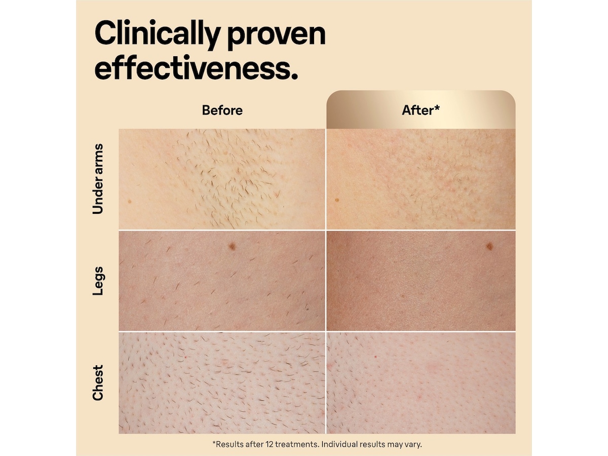 Braun IPL Silk·expert Pro 5 PL5242 (hvit/gull) Epilator & IPL-hårfjerning