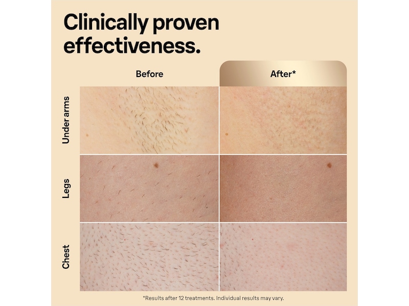 Braun IPL Silk·expert Pro 5 PL5242 (hvit/gull) Epilator & IPL-hårfjerning