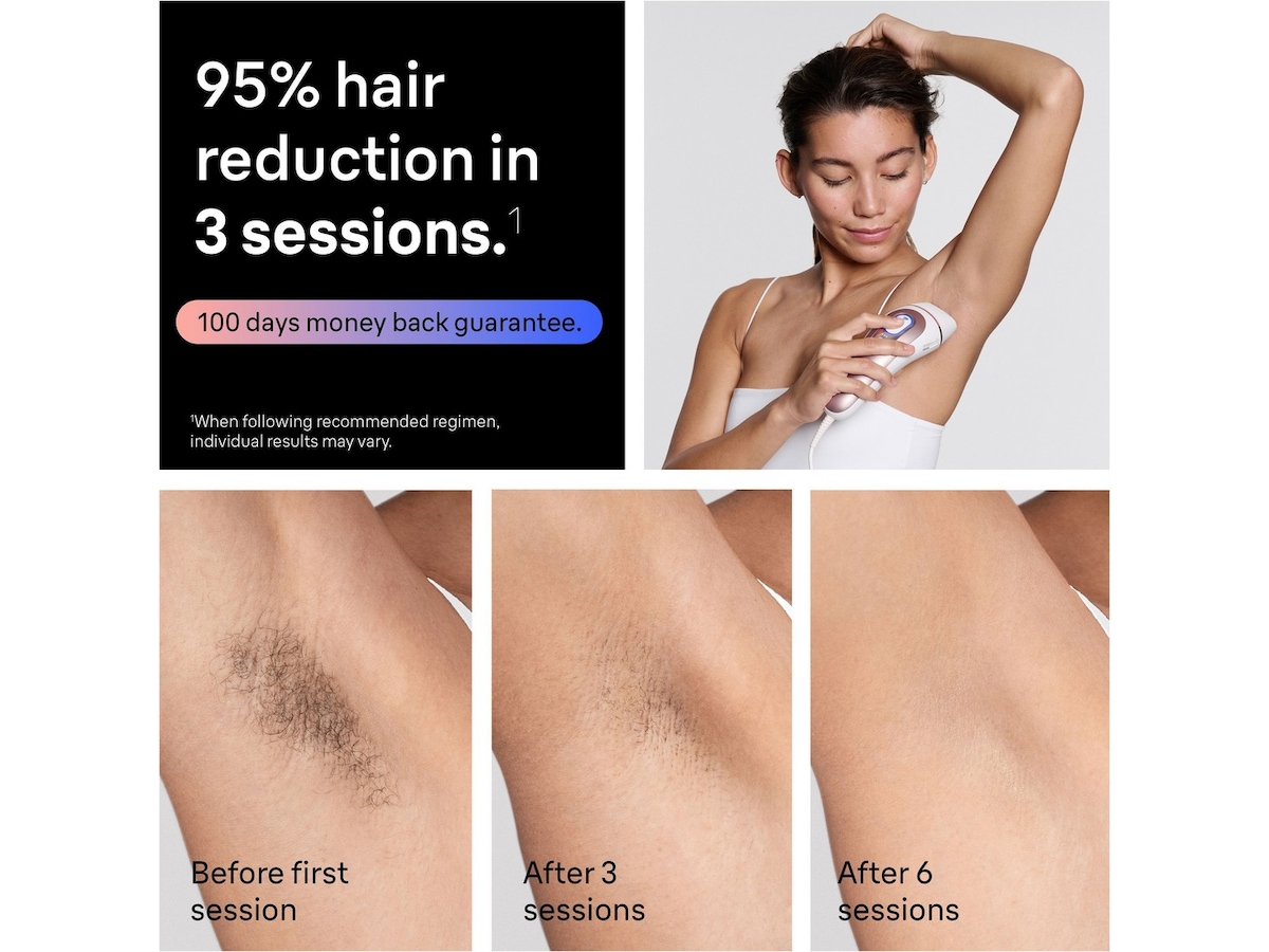 Braun IPL Skin i·expert PL7431 Epilator & IPL-hårfjerning