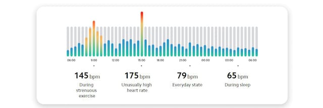 Pulsovervåkning Pulsovervåkning